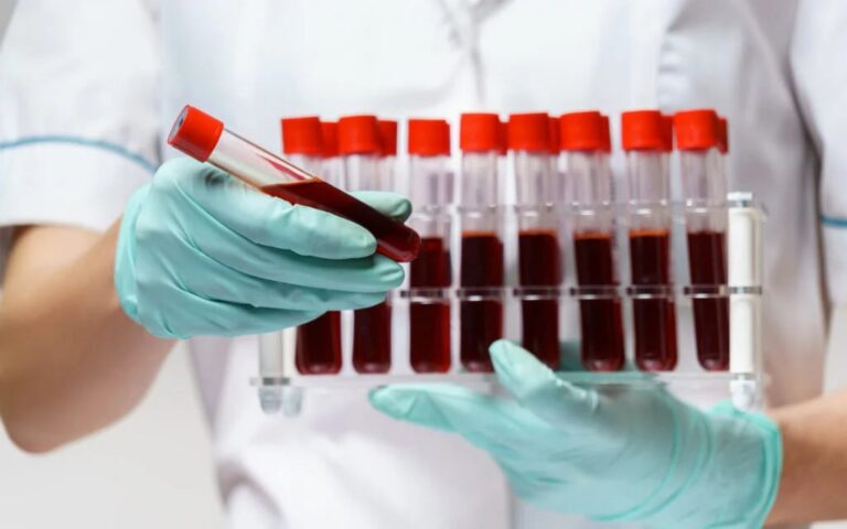 Células contra anemia aplásica grave 